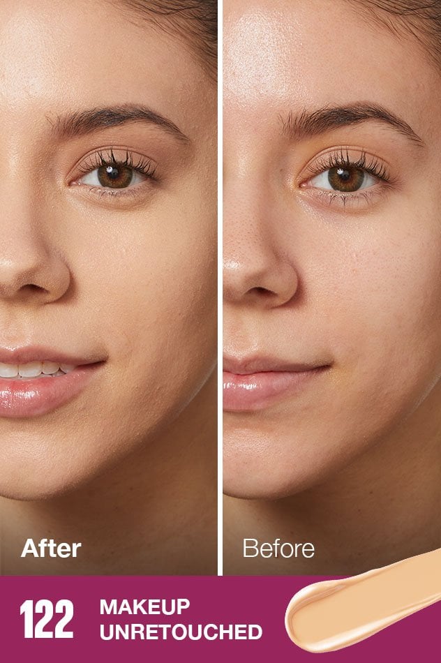 IARConcealer US BeforeAfter 122 632x950